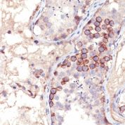 Formalin-fixed, paraffin embedded human testis sections stained with 100 ul anti-MAGE-1 (clone MA454) at 1:300. HIER epitope retrieval prior to staining was performed in 10mM Citrate, pH 6.0.